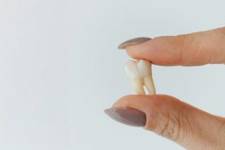 Why Choose DentalCare Carnegie? - Tooth Extractions