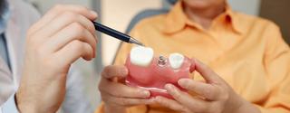Affordable Family Dental Implants