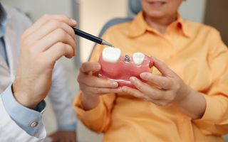 Dental implants, an option for a missing tooth.