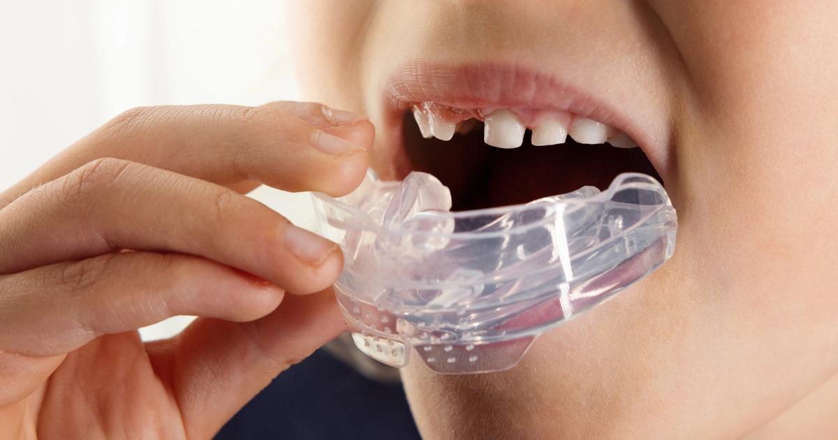 Dental Orthodontic Teeth Trainer – Myobrace & TMJ Appliance For Jaw Alignment