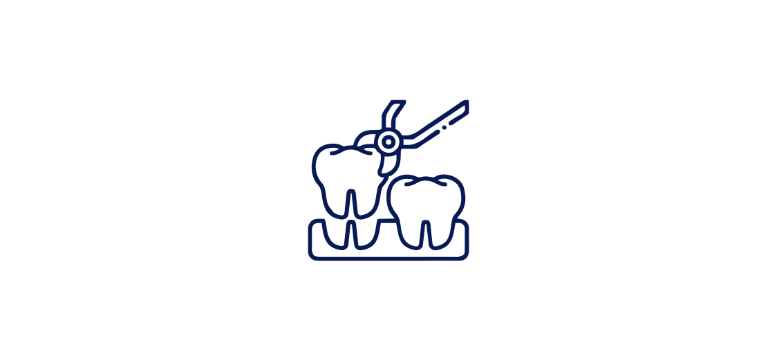 dental extraction illustration