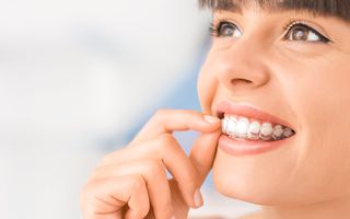 Invisalign®: The clear alternative to traditional braces