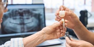 Hero - Save $1,000 On Dental Implant