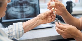 Dental Implants Moonee Ponds Dental Group