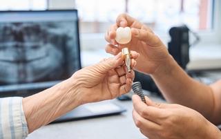 Save $1,000 on Dental Implant Treatments