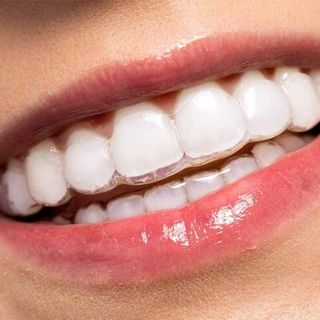 Invisalign 2