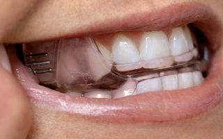 Oral Devices