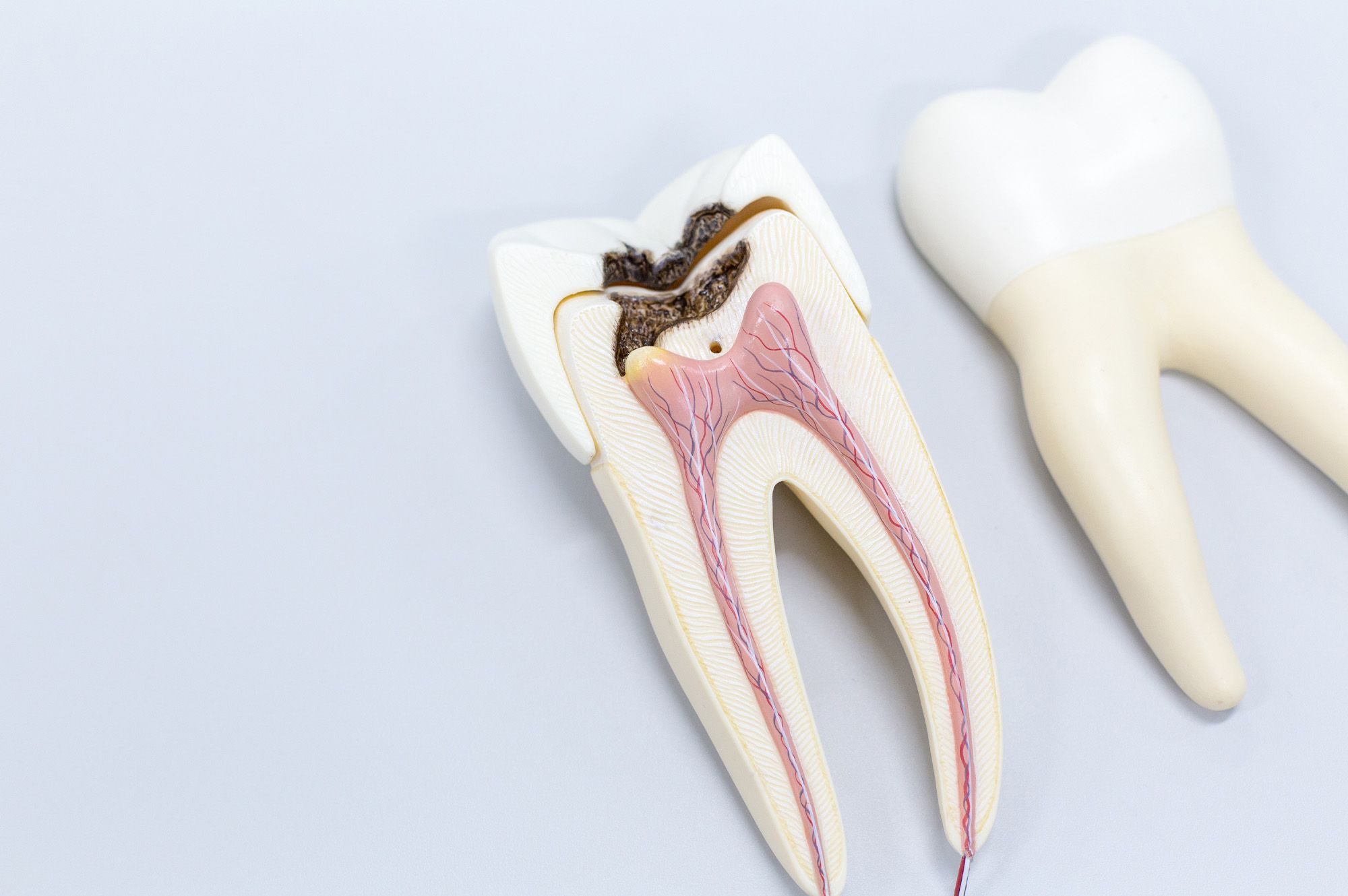 Root Canal Treatment in Carnegie - Hero