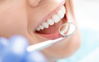 Close-up of patients new white porcelain veneers