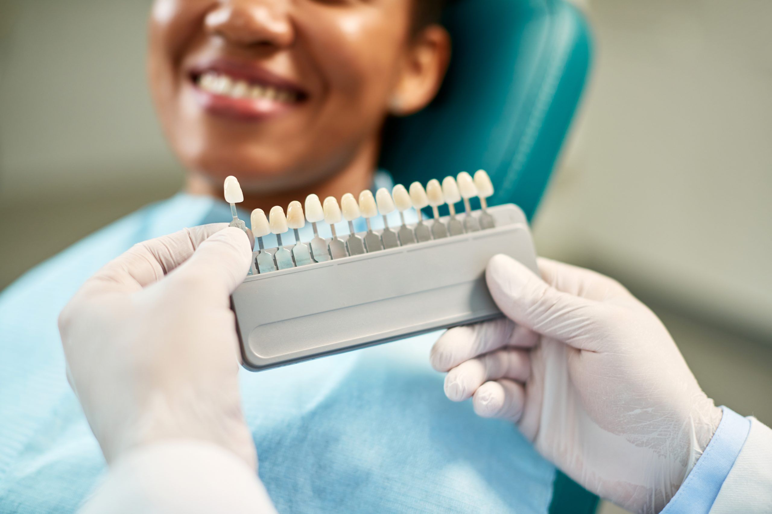 How Long Do Veneers Last? Lifespan and Care Tips - Hero