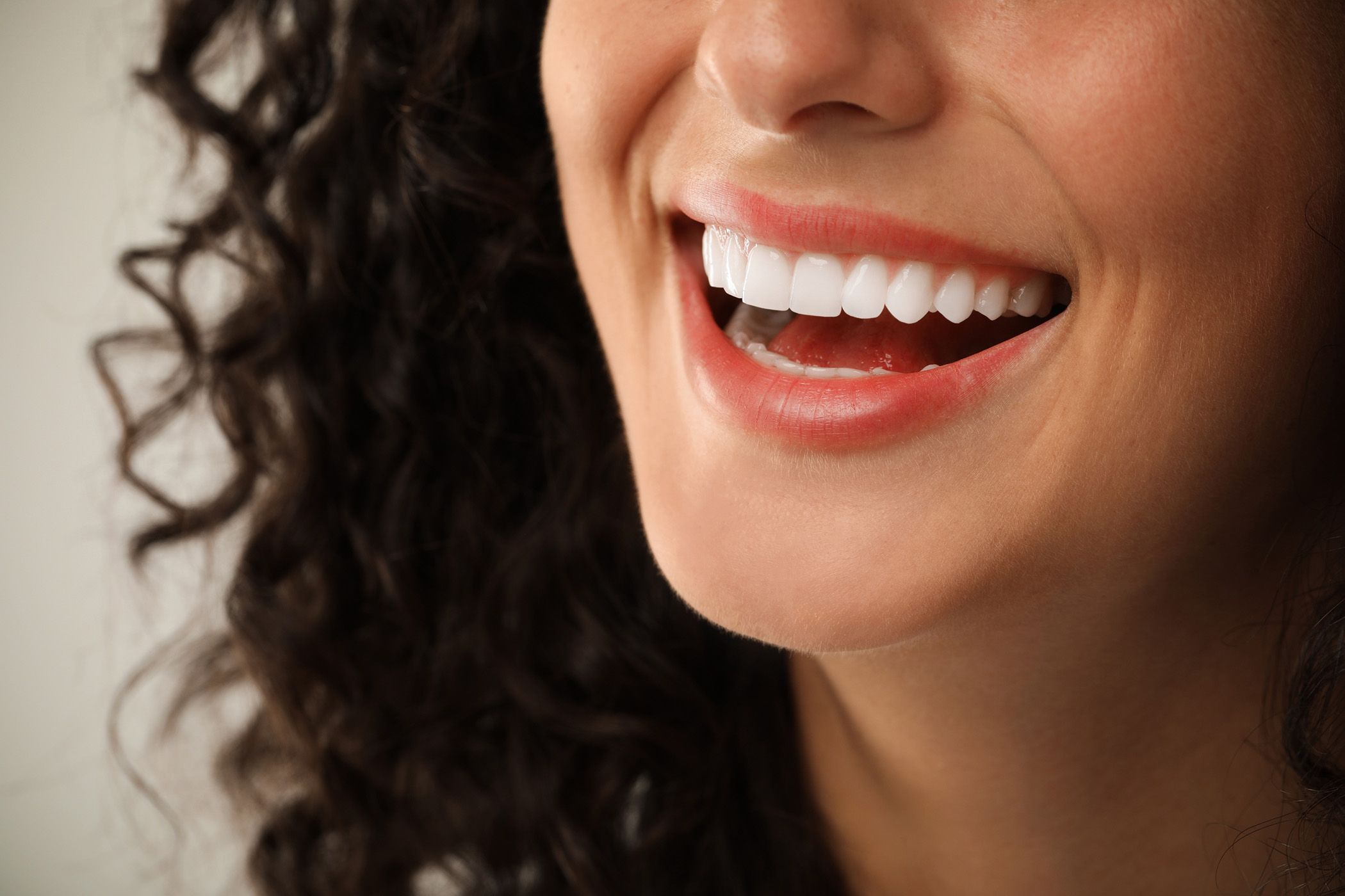 Smile Makeover at Ranford Road Dental Centre in Canning Vale.