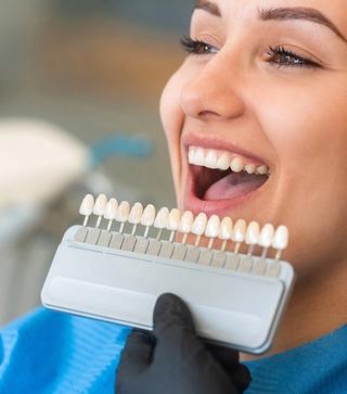 Veneers