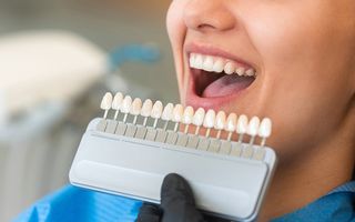 Enhance your smile with Dental Veneers