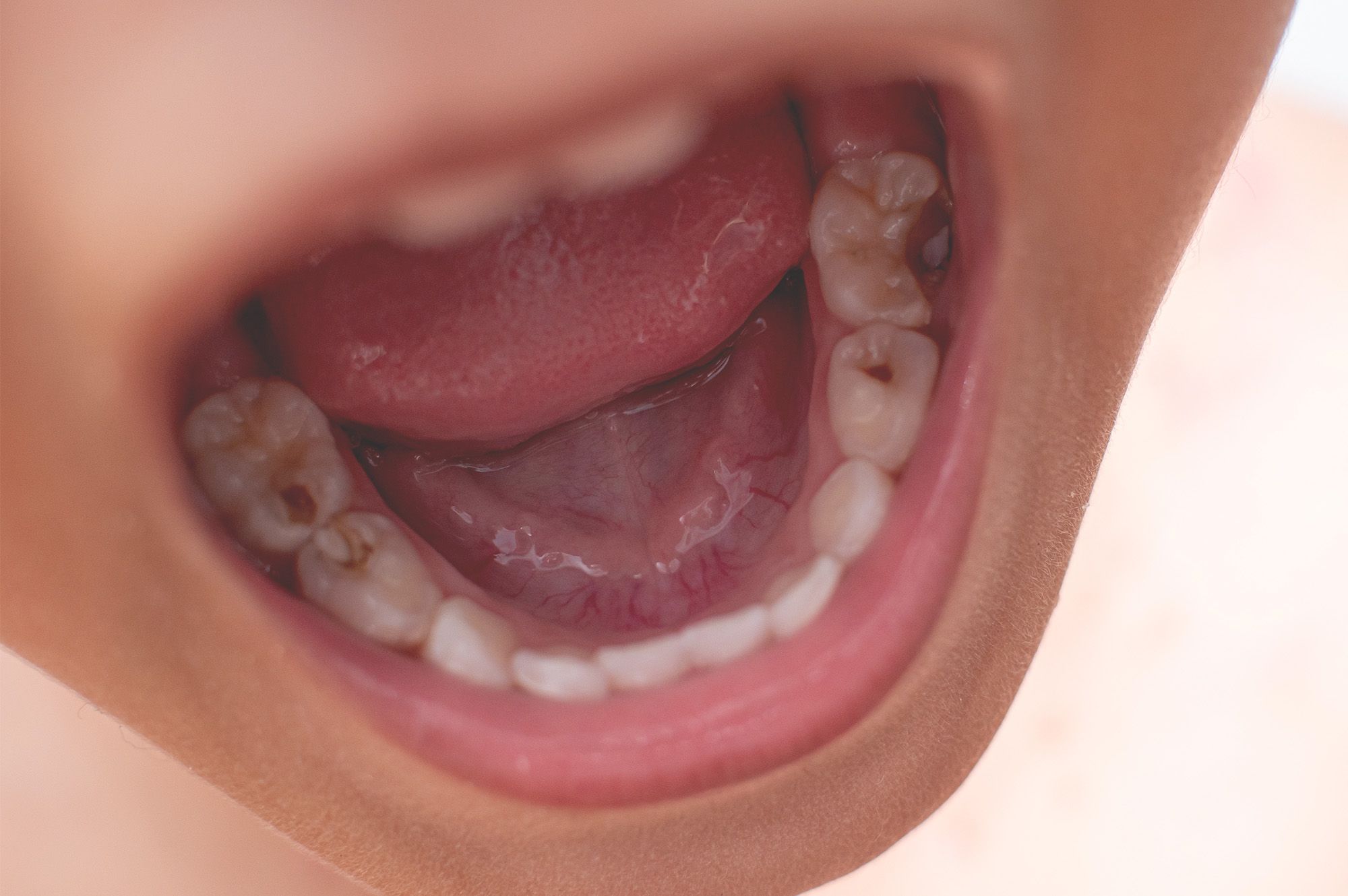 Why Children's Dental Health Matters?