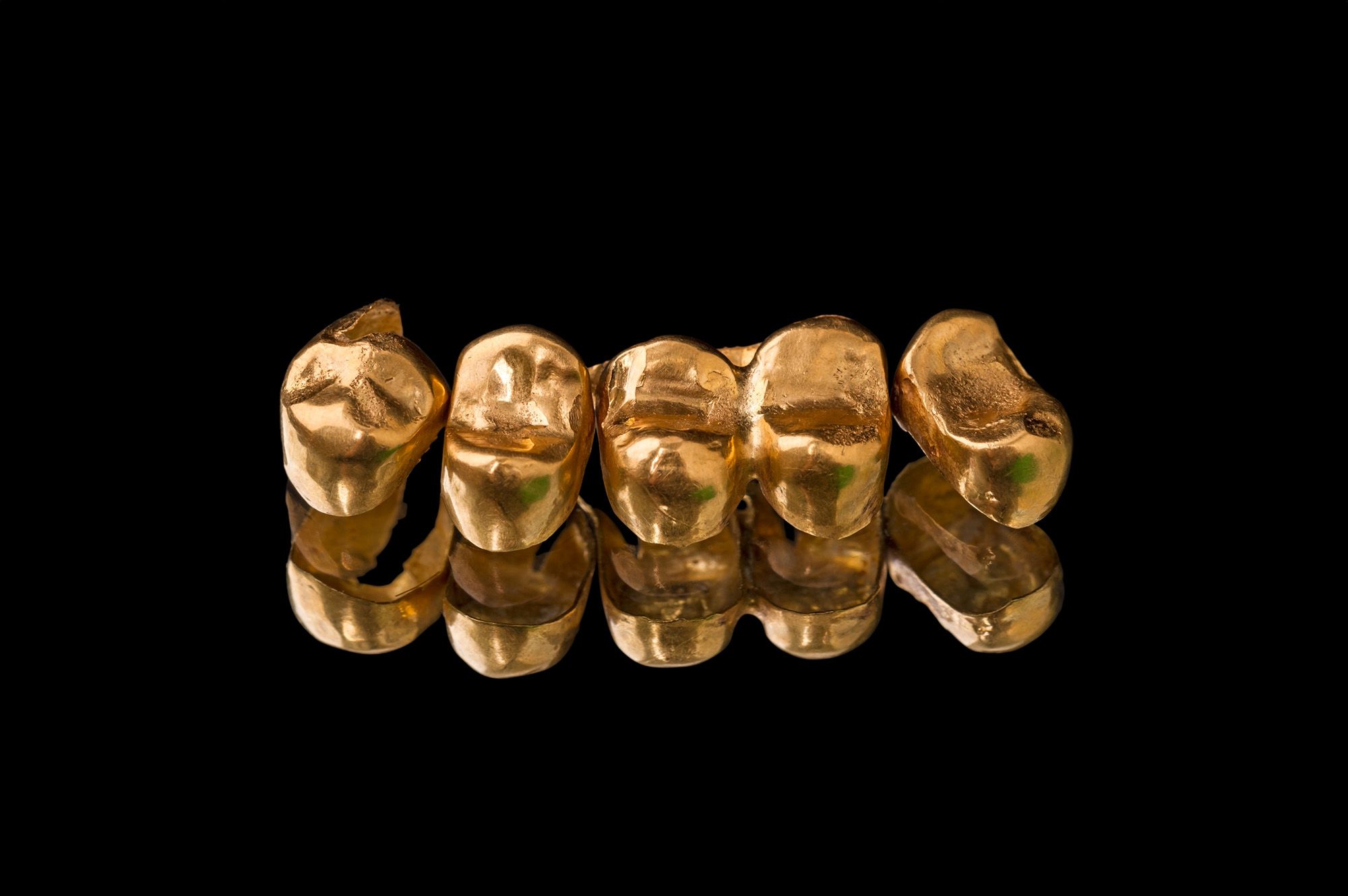 Full Gold Crowns