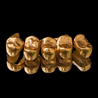 Full Gold Crowns