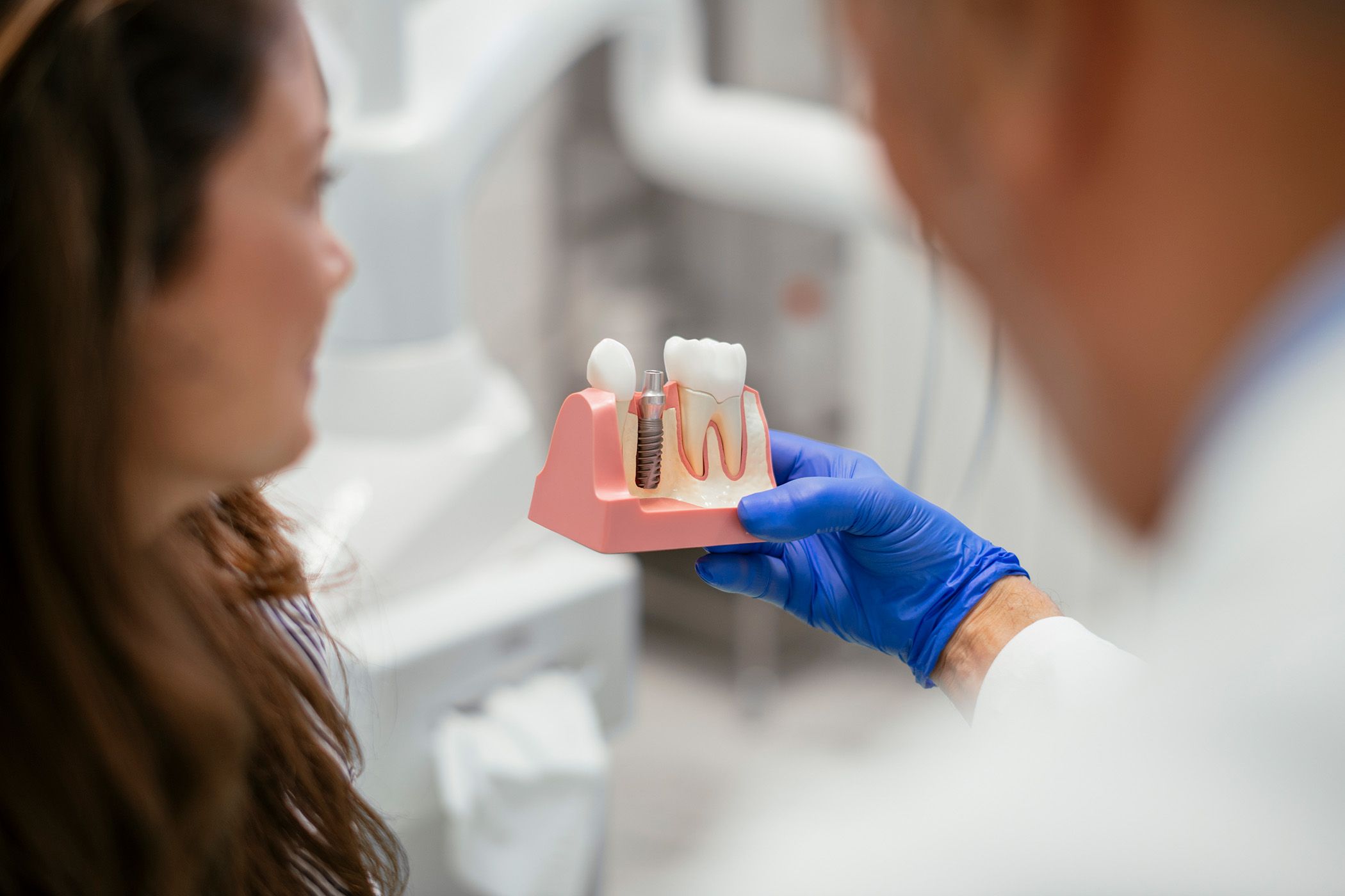 Dental Implants