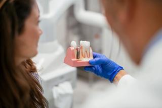 Dental Implants