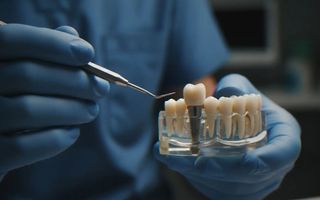 Options for Lost Teeth: Implants, Bridges & Dentures