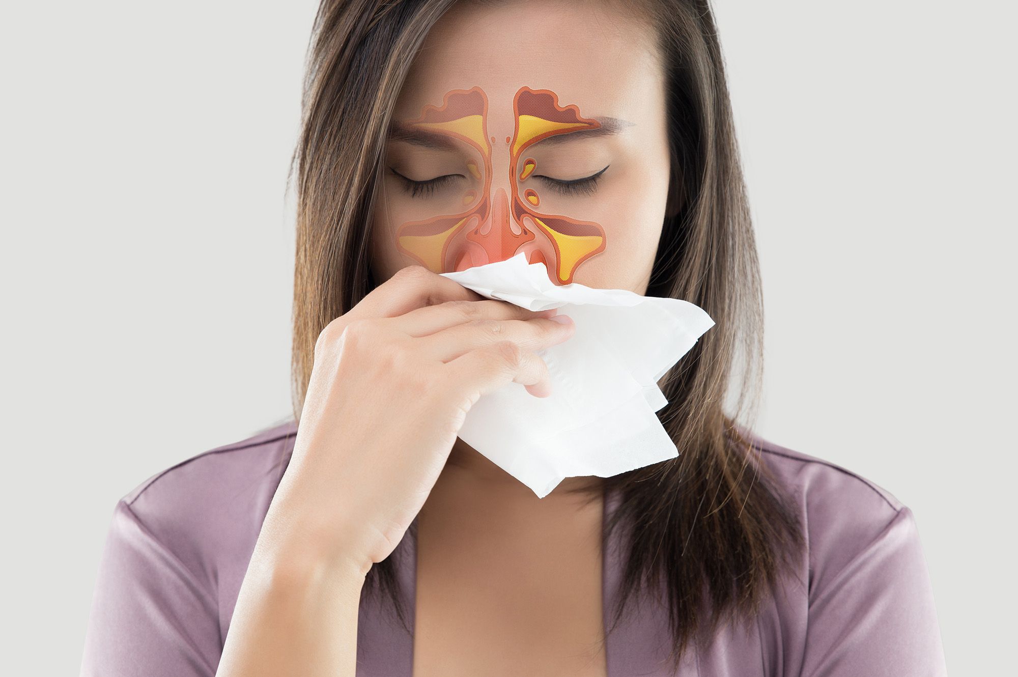 Sinus infection