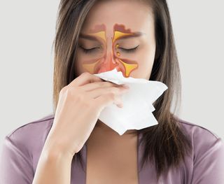 Sinus infection