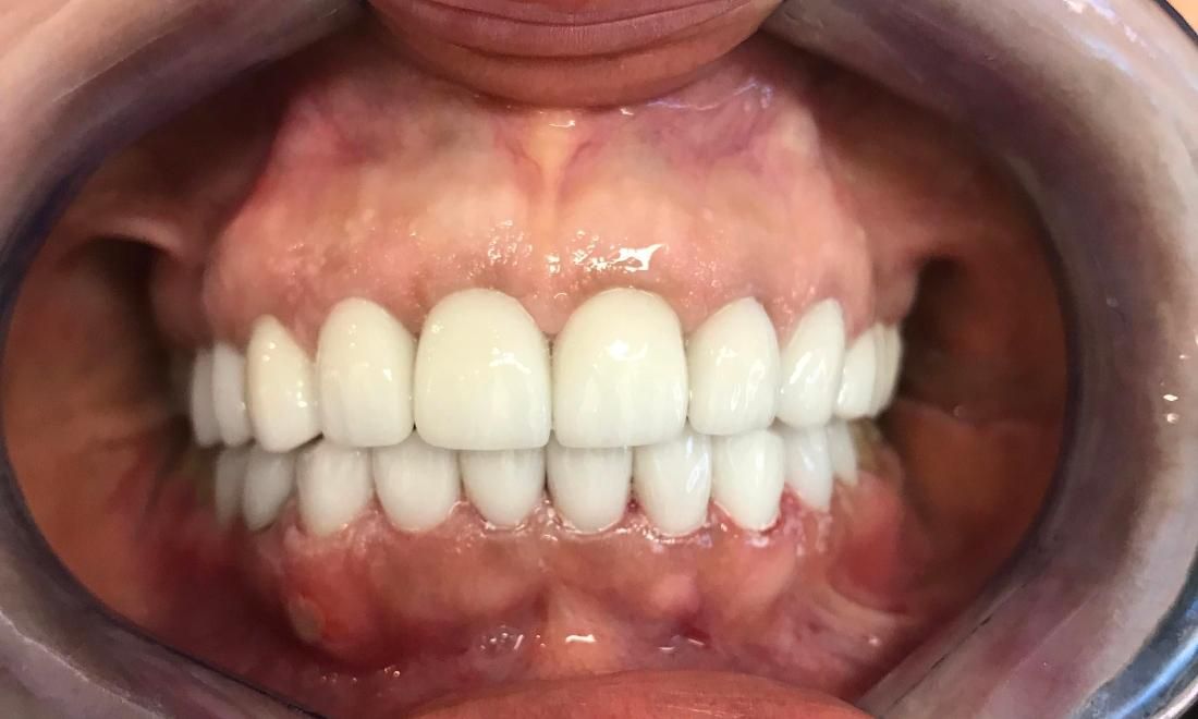 Cosmetic Dentistry - After