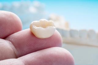 Single tooth crowns