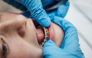 Image of a patient having their braces inspected.