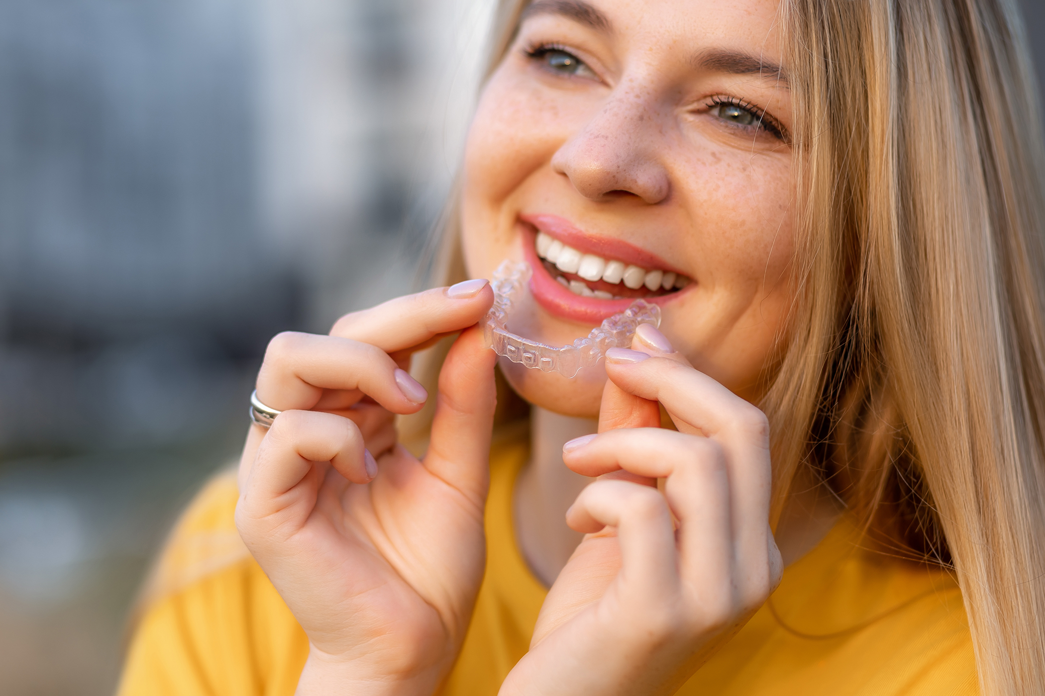 fluoride-treatment