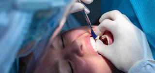 Dental Crowns & Bridges