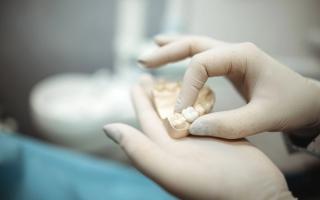 Restore your smile with Dental Crowns