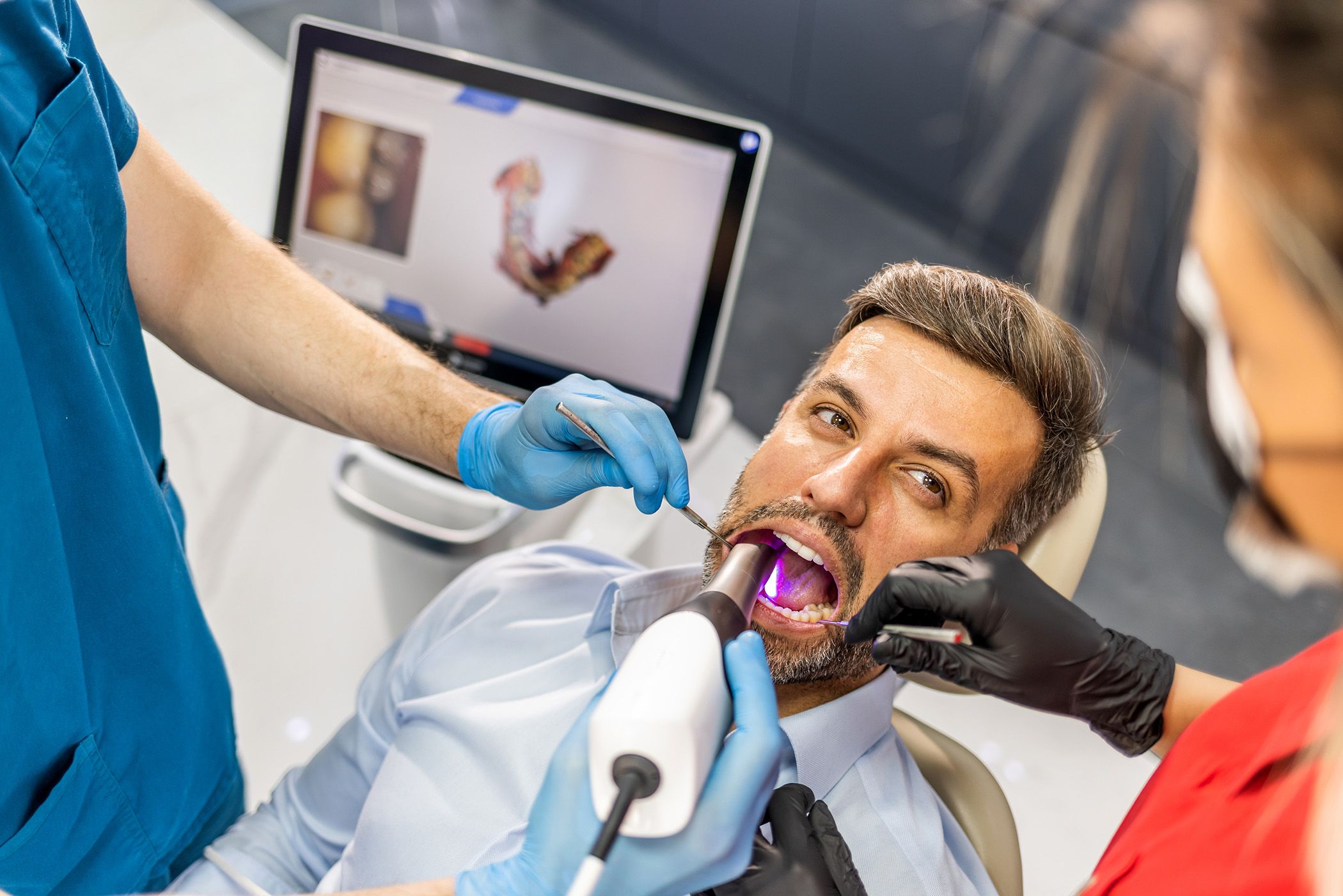 Image of a Intraoral Camera in a patient's mouth.