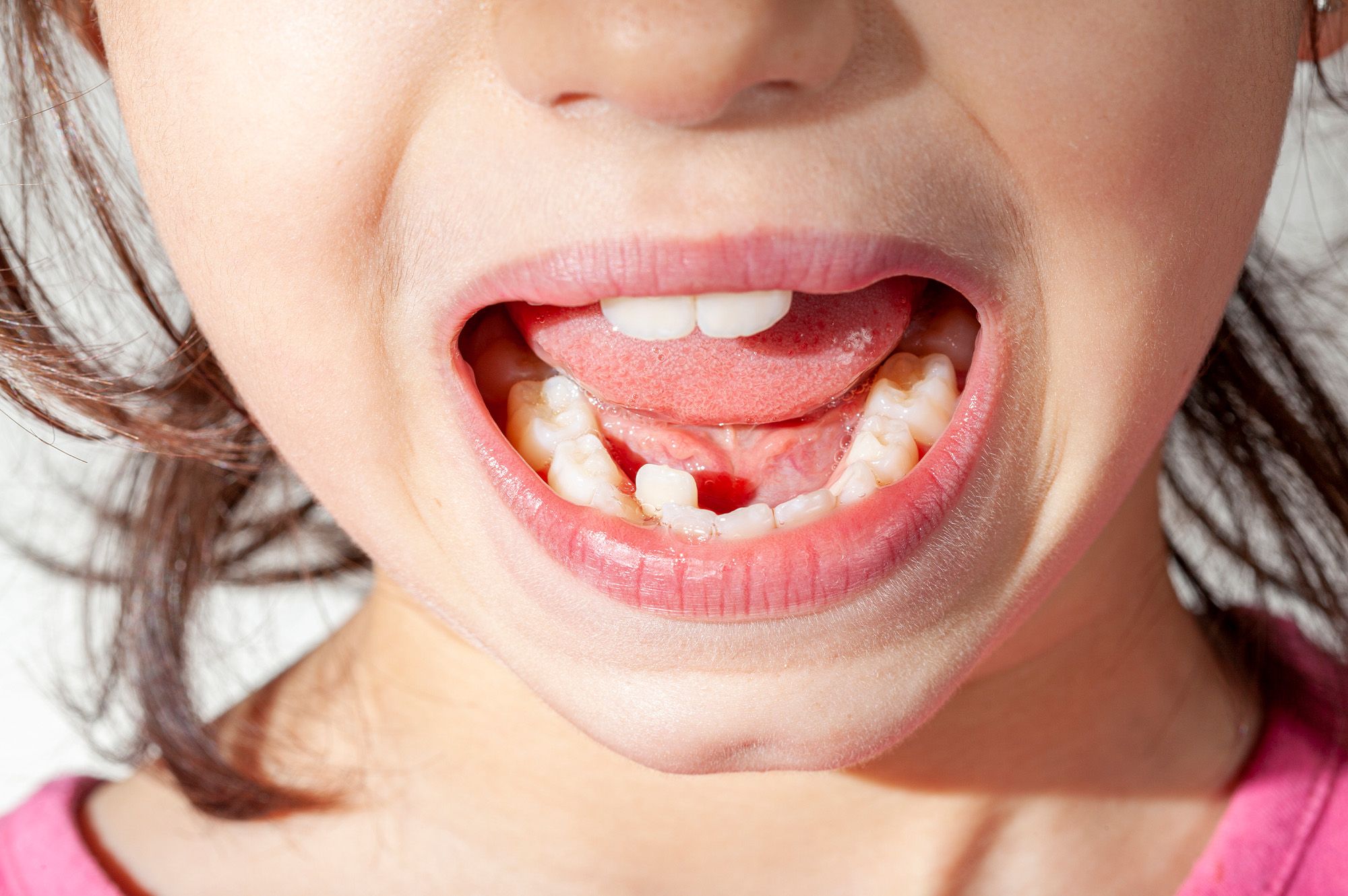 Why Orthodontic Treatment Matters
