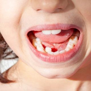Why Orthodontic Treatment Matters