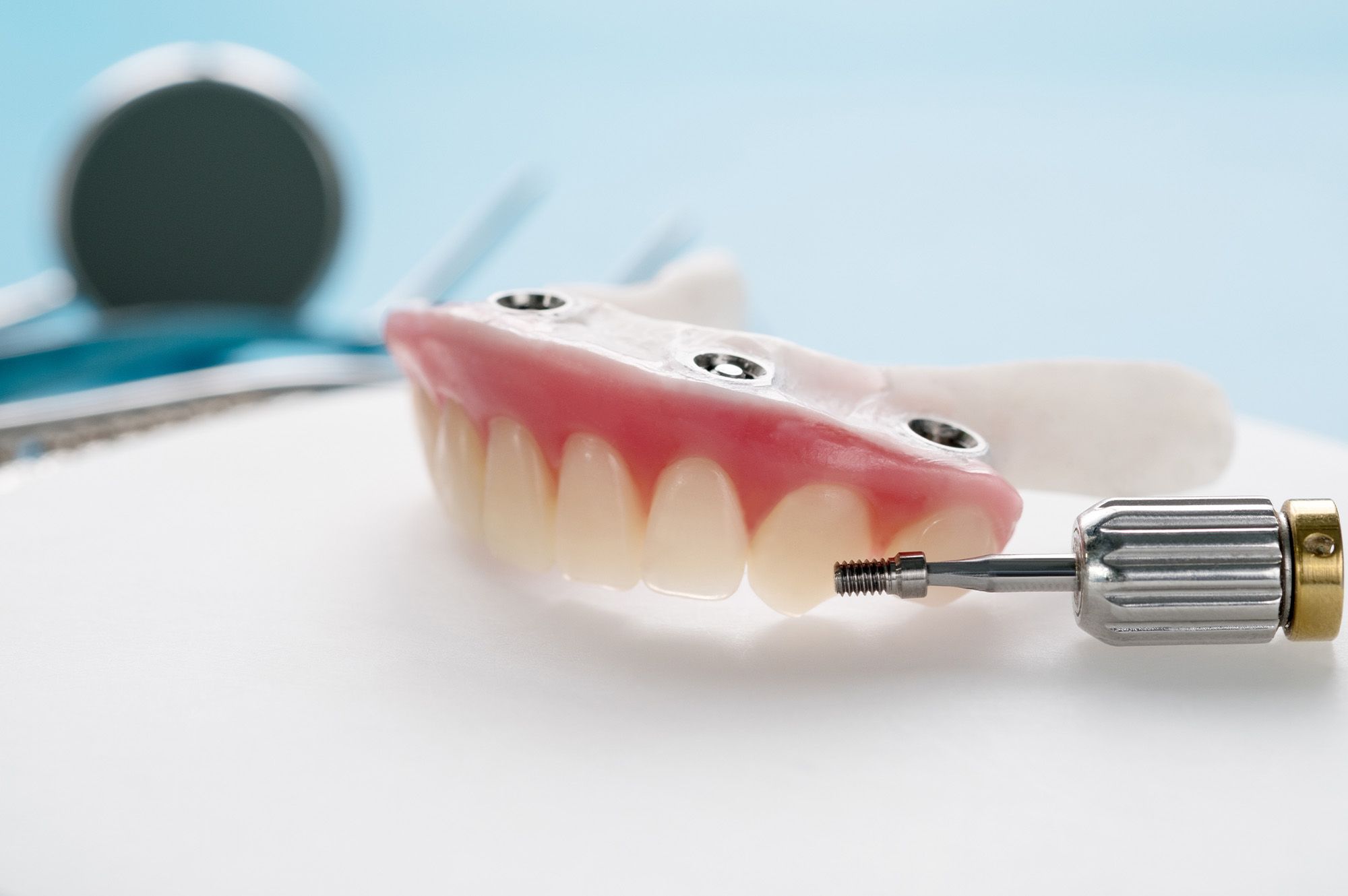 All-On-4® Dental Implants - Hero