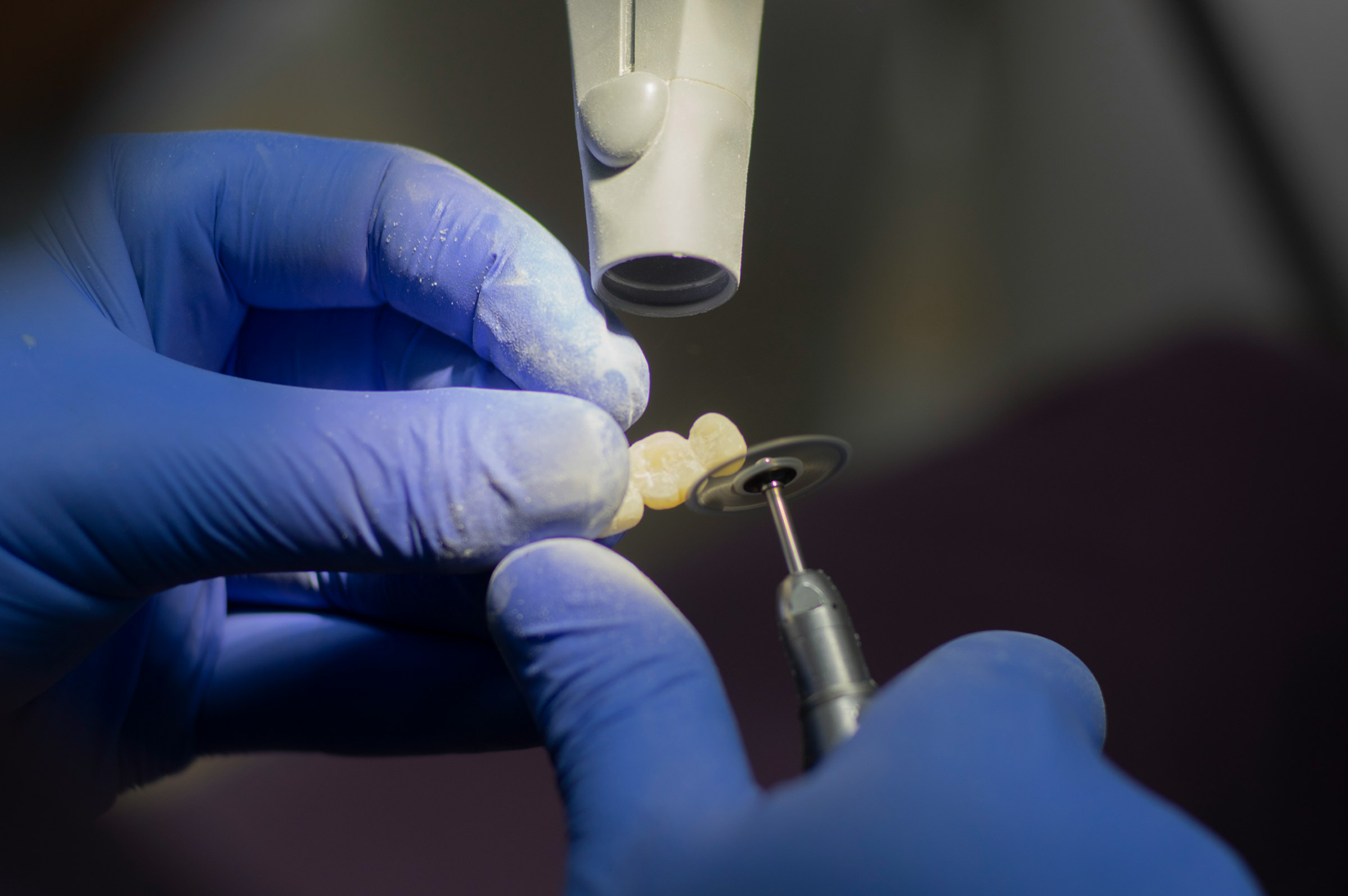 Dental Crowns and Bridges at Ranford Road Dental Centre.
