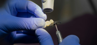 Dental Crowns and Bridges at Ranford Road Dental