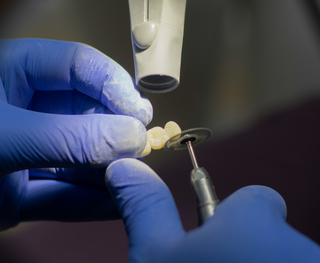 How Much Does A Dental Bridge Cost?