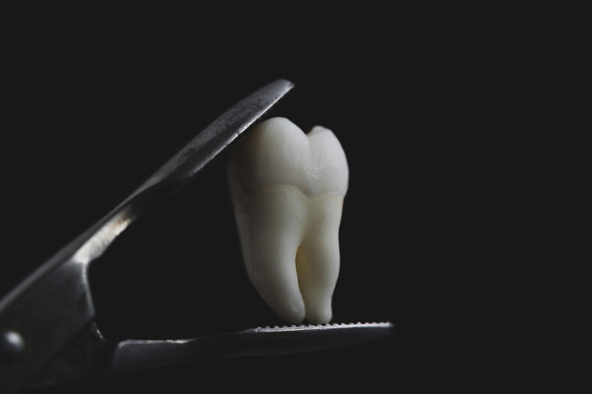 Hero - Tooth Extractions