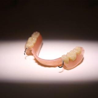 Partial Denture