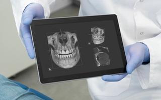 Image of a dentist holding a tablet with x-ray scans.