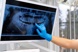Comprehensive Dental Examination