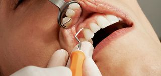 Dental Hygiene