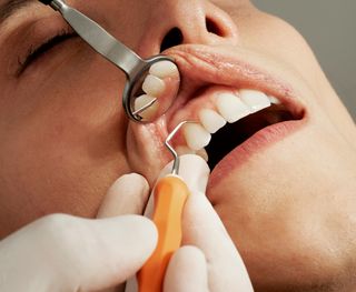 Dental Hygiene - Professional Cleaning