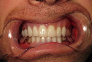 Patient After