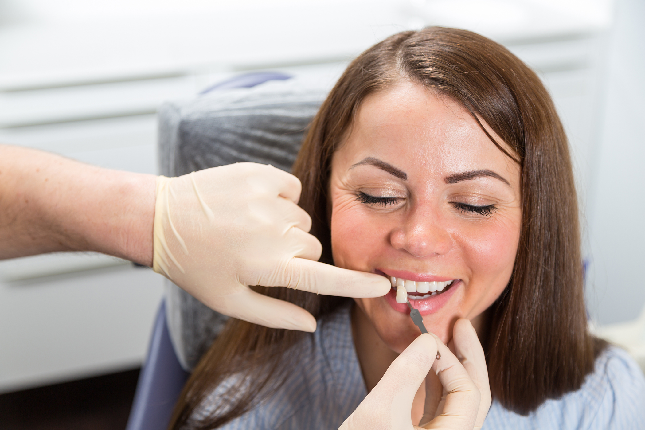 4. Veneer Placement