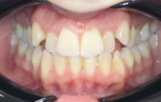 Amy Before