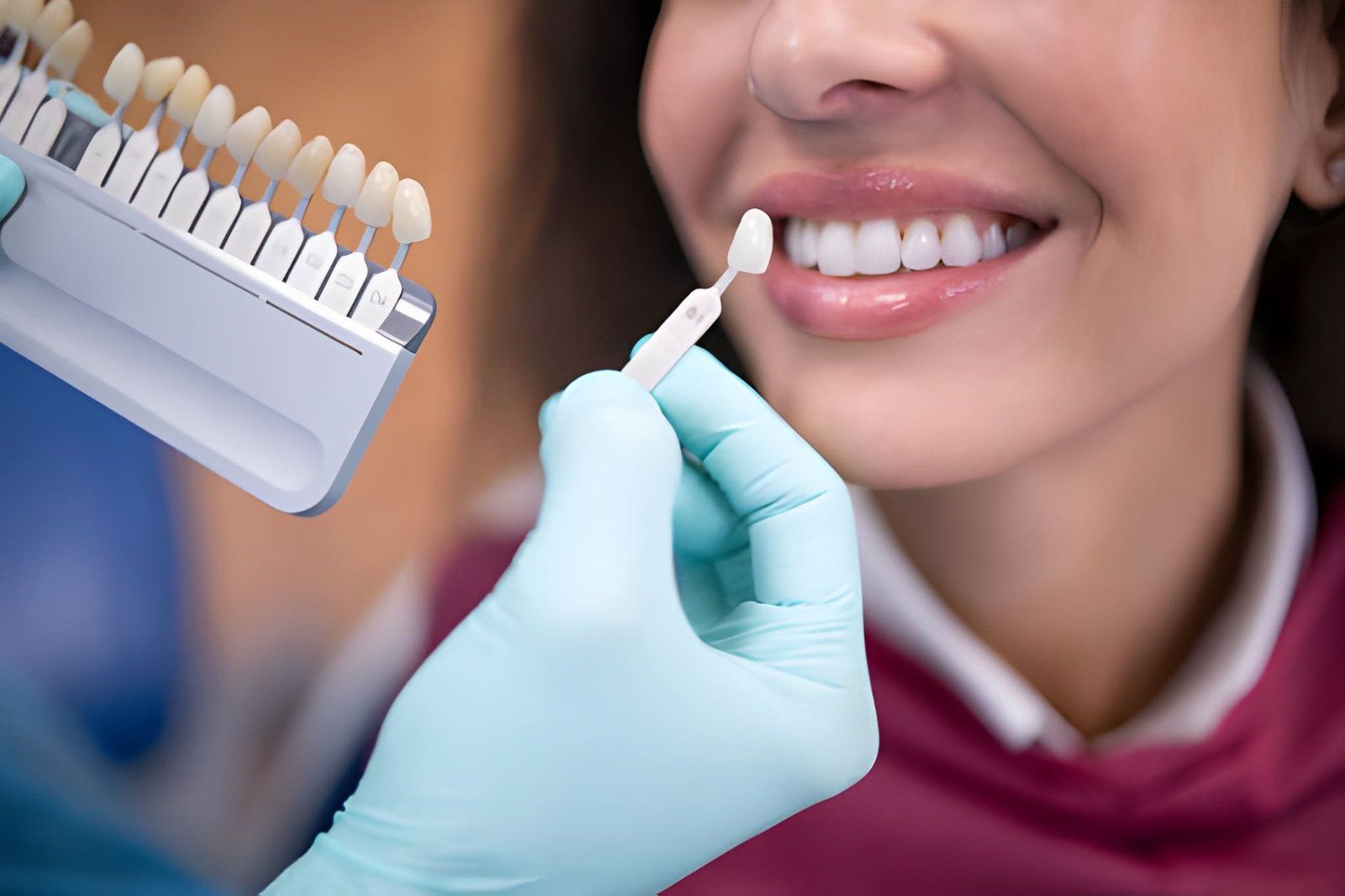 Smile Brilliantly with Veneers in Canning Vale