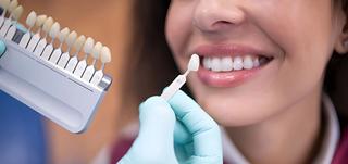 Smile Brilliantly with Veneers in Canning Vale