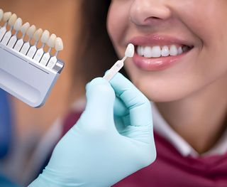 How much do dental veneers cost in Werribee?